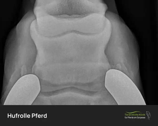 Röntgenbild eines Pferdehufs, das die Knochenstrukturen zeigt. Deutlich erkennbar sind die Gelenke und Knochen, die bei einer Hufrolle beim Pferd betroffen sein können.