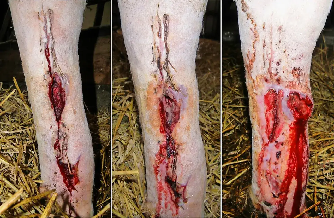 Drei Bilder zeigen ein stark blutendes, genähtes Bein mit offenem, tiefem Fleisch. Es sieht aus wie ein Unfall mit wildem Fleisch.